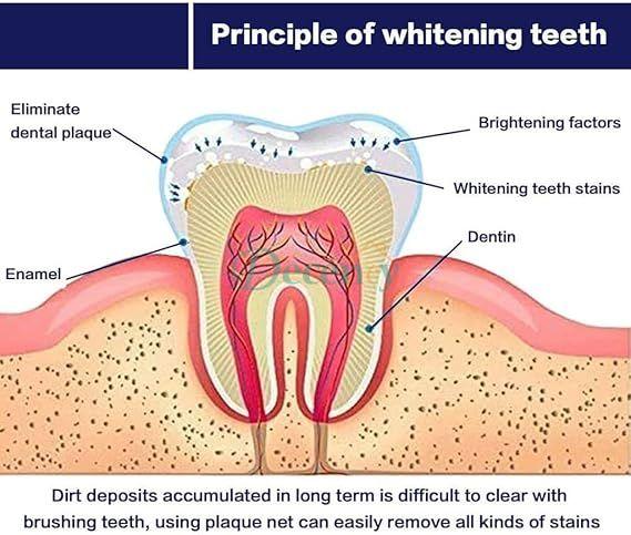 Teeth Whitening Pen