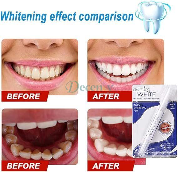 Teeth Whitening Pen