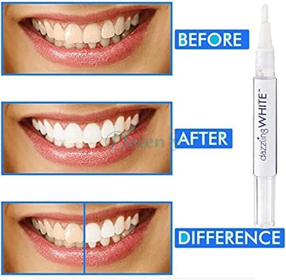Teeth Whitening Pen